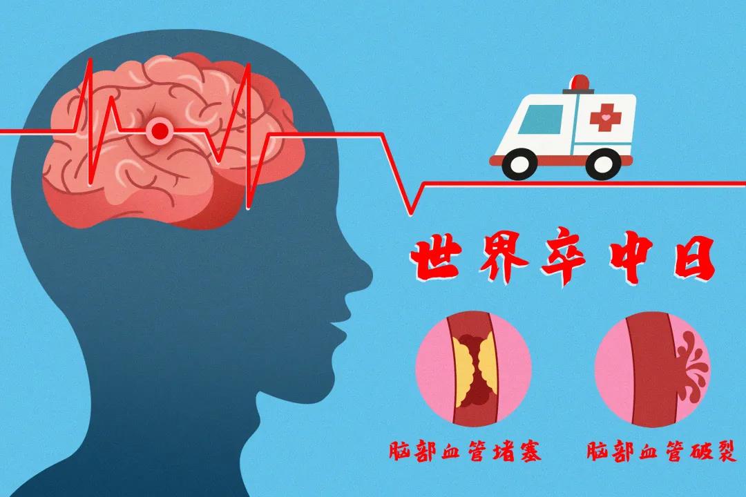 脑卒中的九大误区，您了解吗 | 世界卒中日