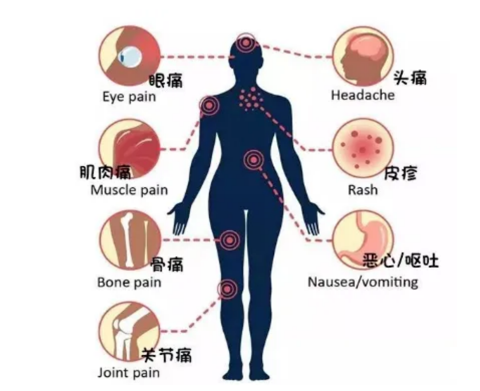 如何预防登革热？海口疾控中心在线科普