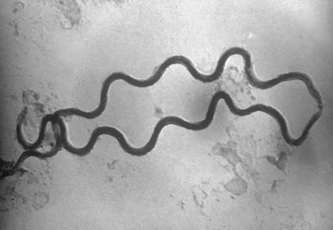 梅毒的8大常见误区，很多人都搞错了！